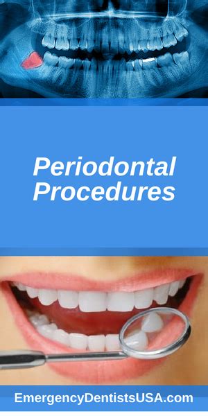 periodontics near me|american board of periodontics.
